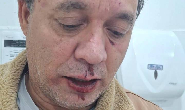 Discussão entre o prefeito de Nova Independência (SP) e médico de hospital particular de Andradina (SP) termina em violência