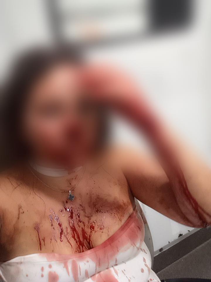 Oito pessoas podem ser indiciadas por tentativas de homicídios contra duas mulheres na virada do ano em Nova Independência (SP)