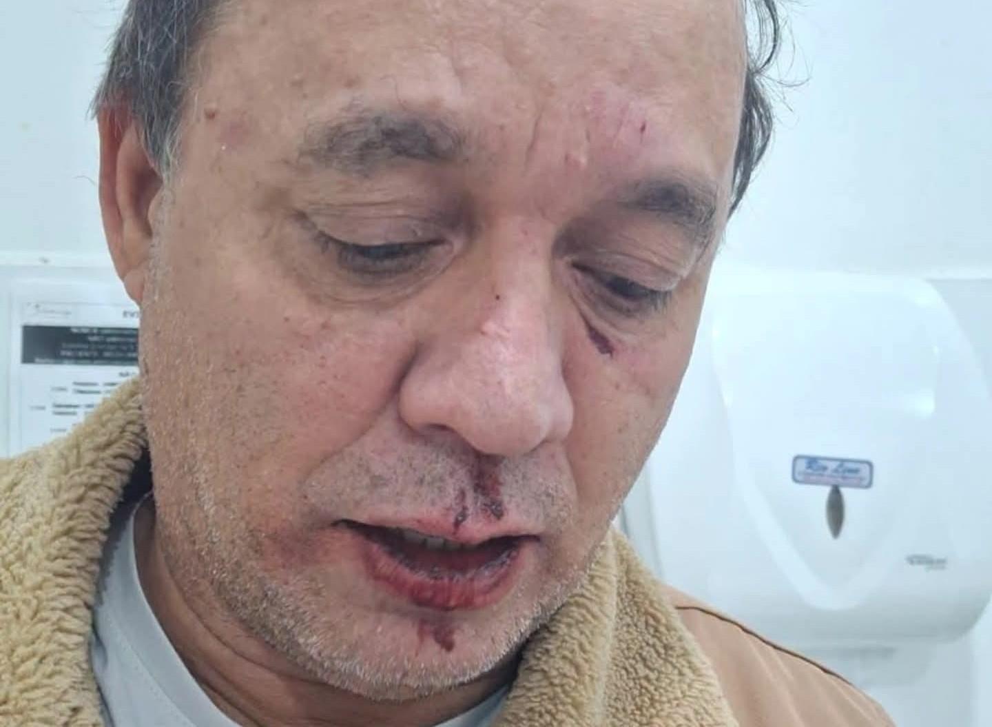 Discussão entre o prefeito de Nova Independência (SP) e médico de hospital particular de Andradina (SP) termina em violência